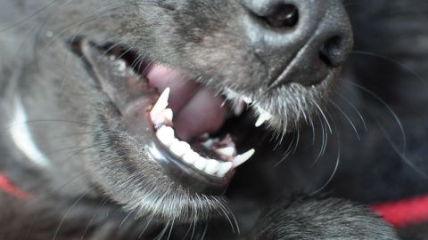 Ivars permanenta tänder tränger undan mjölktänderna.