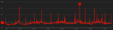 Pulskurva vid sömn.